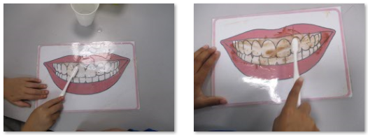 Photos of cleaning teeth